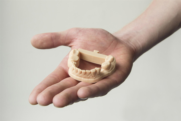 3D printing in smile dentistry